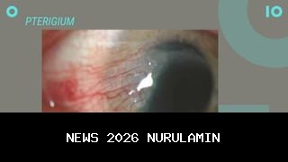 Hari Radiologi Sedunia 8 November: Mengenang Sinar-X, Menjaga Mata Kedokteran Modern