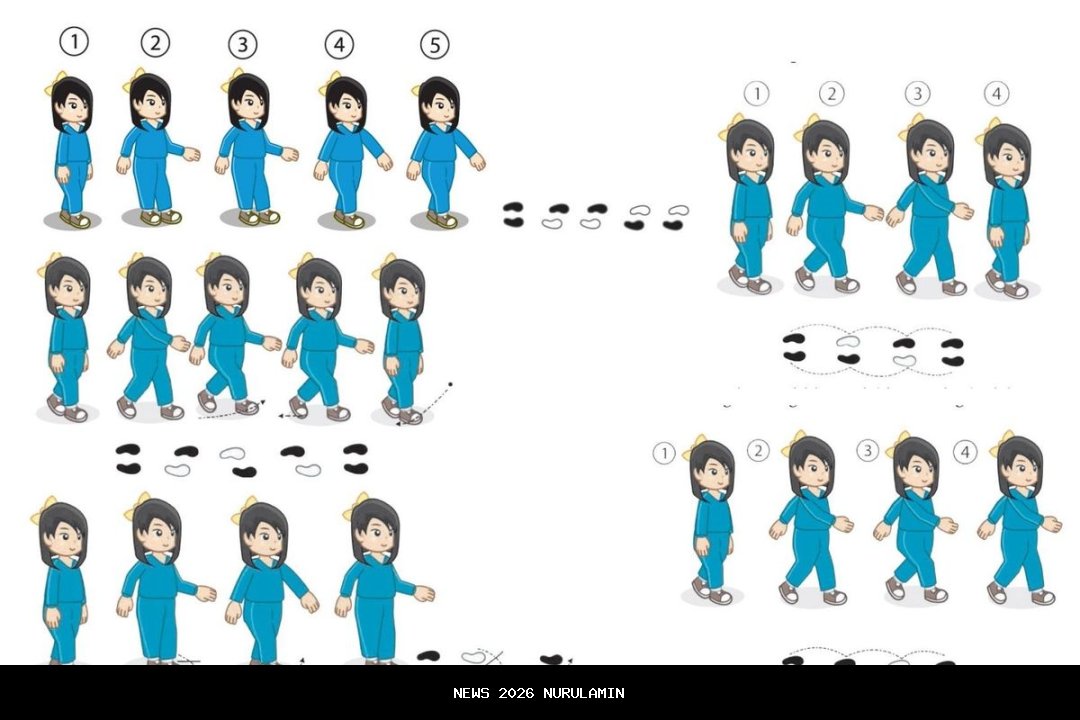 Langkah Deteksi Aneurisma, Ancaman Kesehatan Kim Kardashian