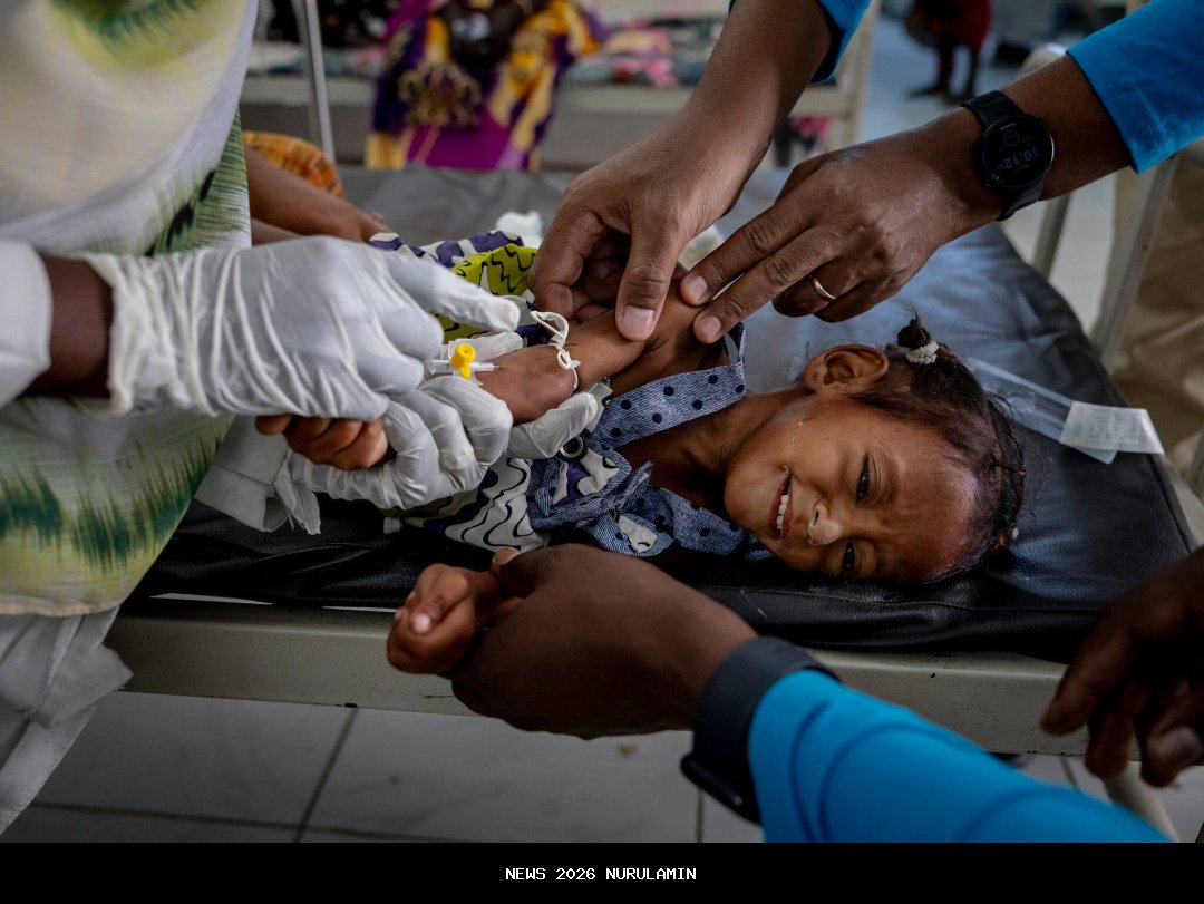 Kekurangan Gizi di Sudan, 63 Orang Meninggal dalam Seminggu