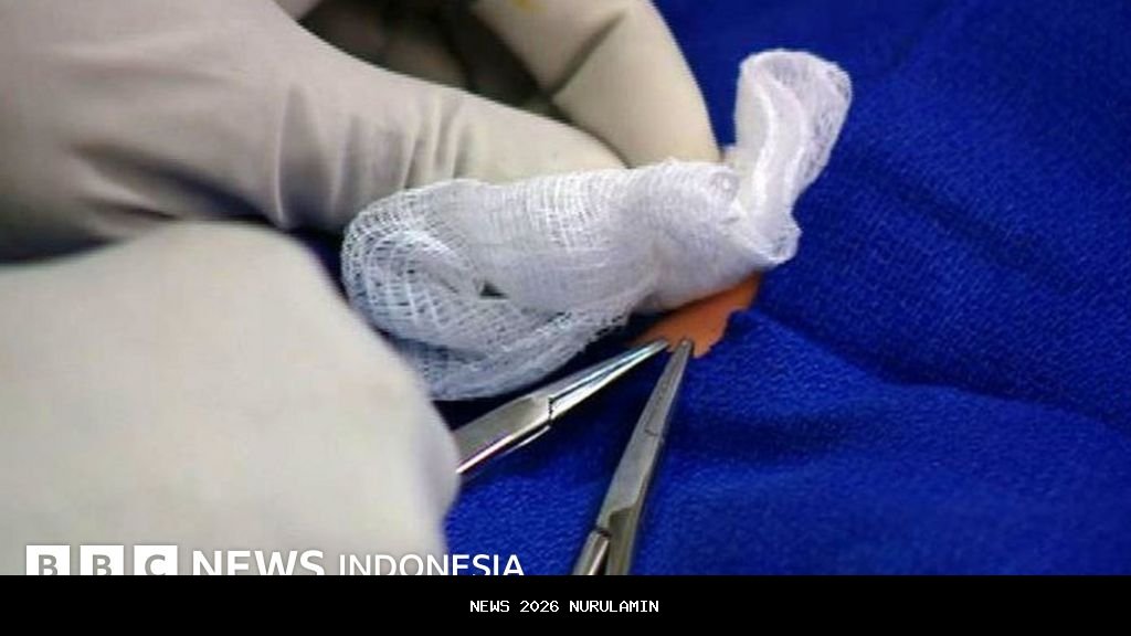 Penyebab Kematian Bayi 6 Bulan Dibanting Ayah Kandung Saat Listrik Padam