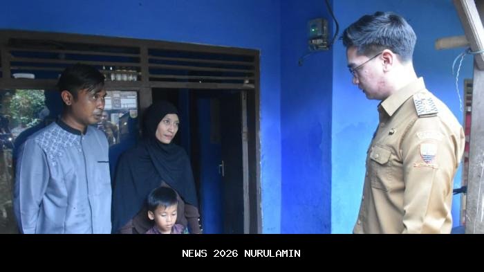 Wabup Sumedang Jemput Bocah 7 Tahun yang Lahir Tanpa Anus